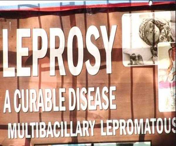 On which day the Anti-Leprosy Day was observed in India? 