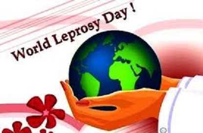 The World Leprosy Day was observed on?
